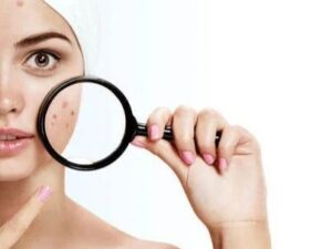 کرم ضد جوش بی رنگ ویتالیر 